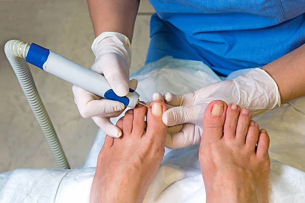 Huntsville ingrown toenail doctor